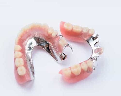 Cobalt-chrome-denture